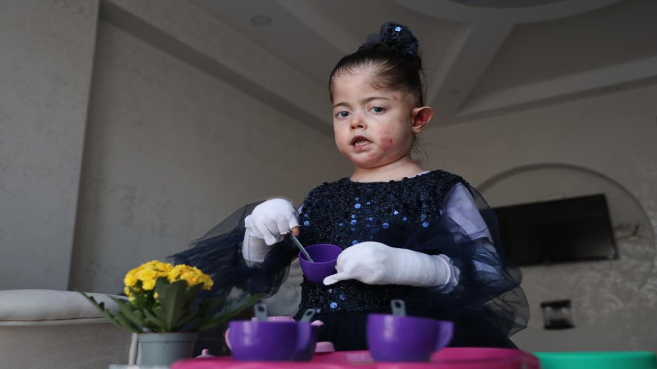 Kelebek hastası 7 yaşındaki çocuk yetkililerden yardım bekliyor